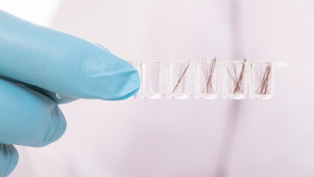 Po 80 rokoch identifikovali obeť Hirošimy. Pravdu odhalilo DNA z vlasov