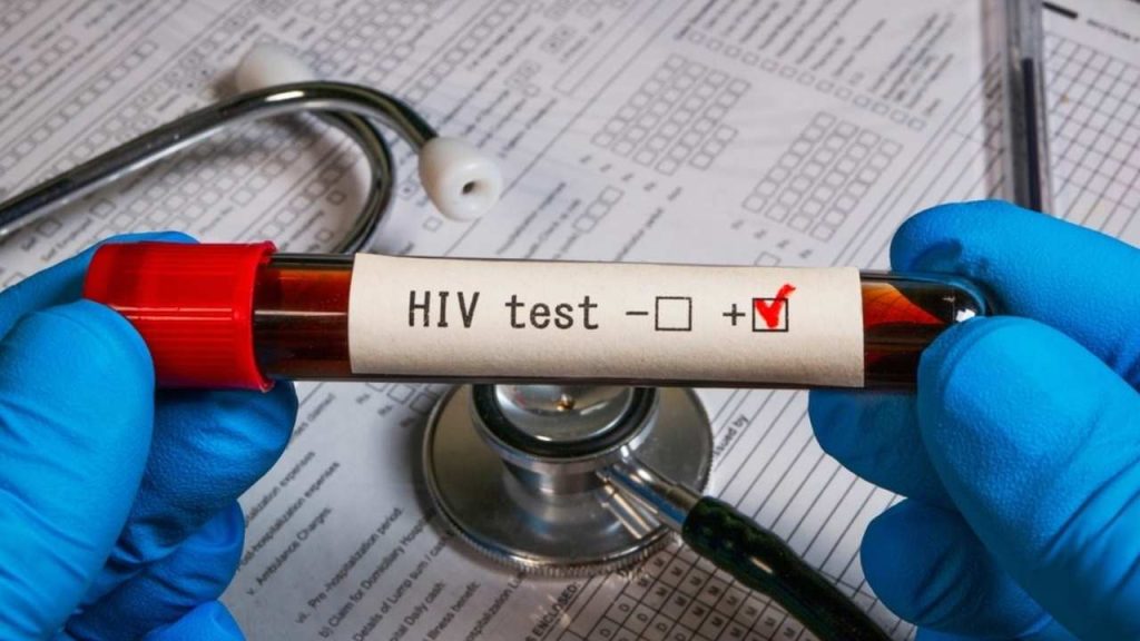 Prelom v boji proti HIV: „Pacient z Osla“ je pravdepodobne vyliečený po transplantácii