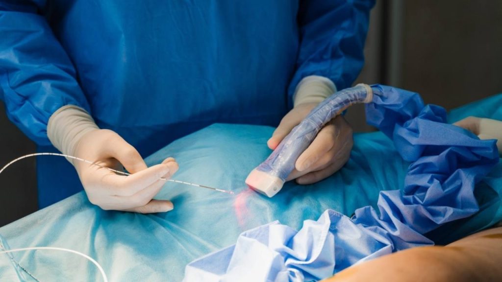 Ilustračná fotografia: Laserové svetlo možno pri niektorých medicínskych zákrokoch privádzať do tela pomocou tenkého optického vlákna. Nová experimentálna terapia rakoviny pankreasu využíva podobný princíp na aktiváciu svetlocitlivého lieku v presne určenej oblasti. Foto: Rabizo Anatolii / Shutterstock